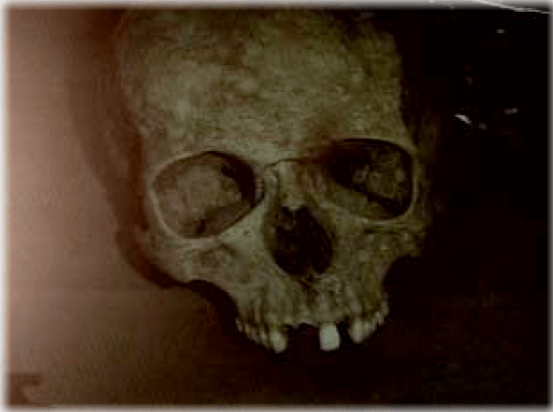 Modalidad de muerte Jorge Matute Johns+cadaver+Muerte+Caso+Matute