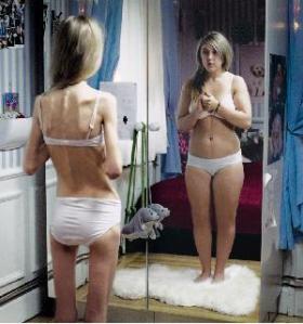 Psicologo en Concepcion - Anorexia